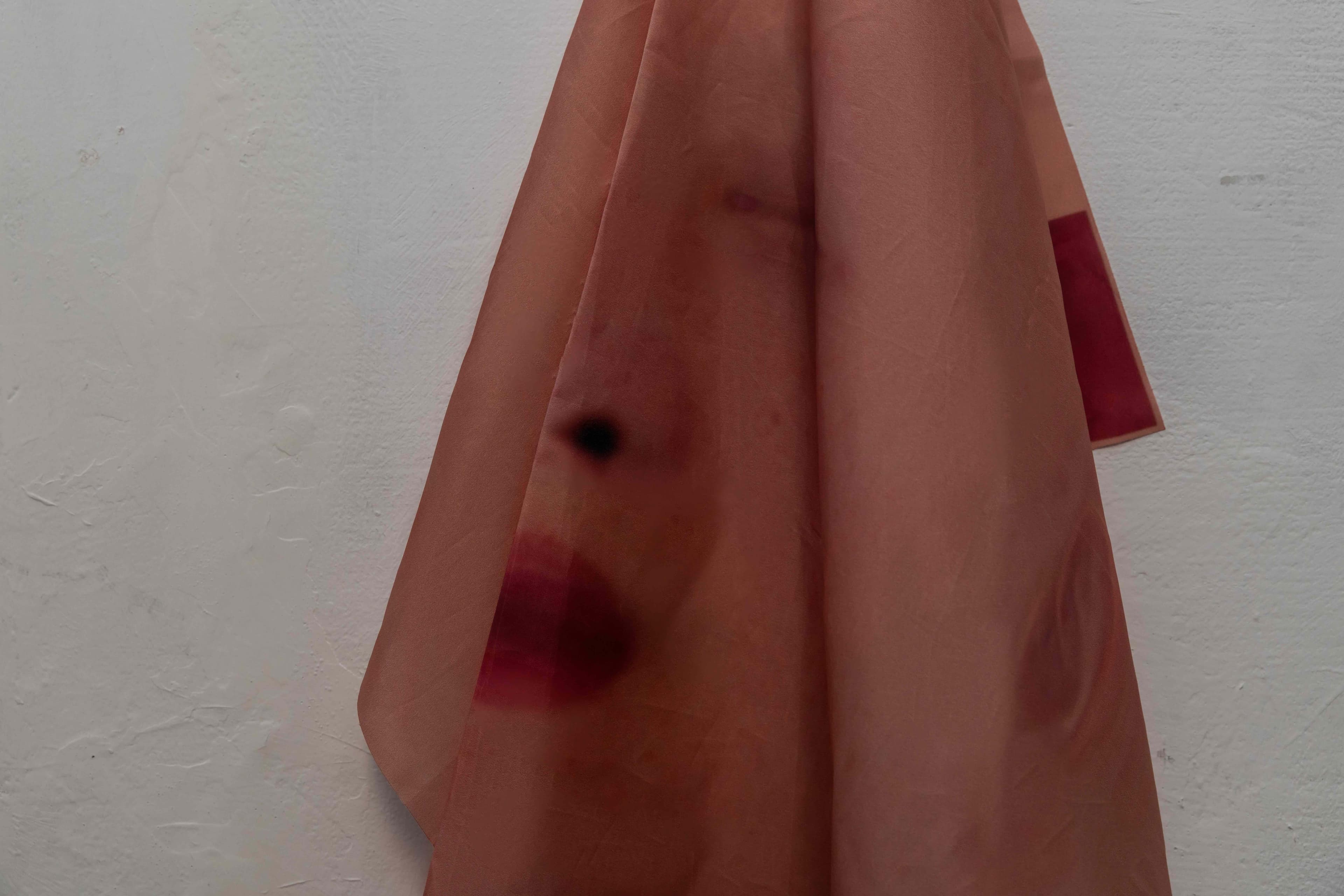Skin - view 2